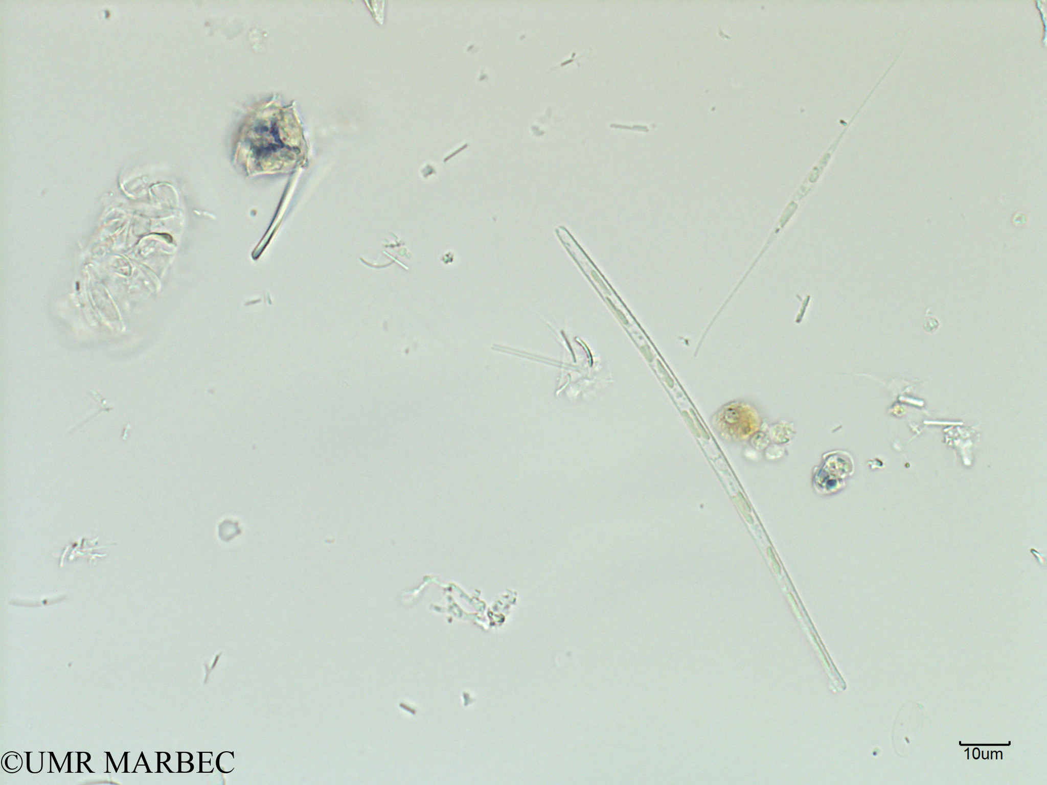 phyto/Scattered_Islands/iles_glorieuses/SIREME May 2016/Thalassionema sp5 cf frauenfeldii (Pennée spp 5-10x50-100µm -SIREME-Glorieuses2016-GLO6surf-271016-photo13)(copy).jpg